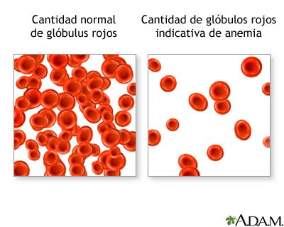 DIETA ANTICOLESTEROL Y TRIGLICERIDOS